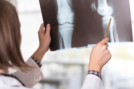 Caregiver examines x-ray of of knee joint